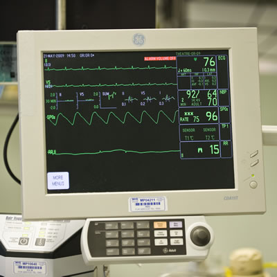 Close up of a cardiac monitor