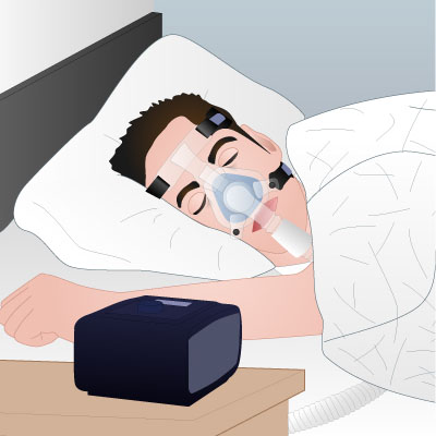 Using a cpap