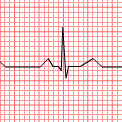 Electrocardiograph (ECG) trace